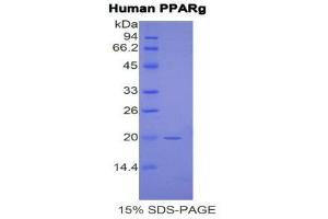 SDS-PAGE (SDS) image for Peroxisome Proliferator-Activated Receptor gamma (PPARG) (AA 349-488) protein (His tag) (ABIN2121859)