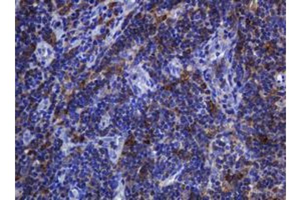 SOAT2 antibody  (AA 1-120)