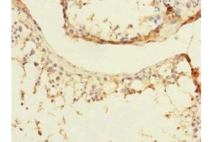 Immunohistochemistry of paraffin-embedded human testis tissue using ABIN7165266 at dilution of 1:100 (DIAPH2 antibody  (AA 1-120))
