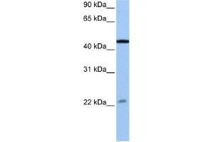 WB Suggested Anti-EWSR1 Antibody Titration:  0. (EWSR1 antibody  (N-Term))