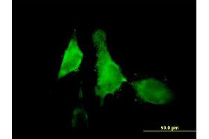 Immunofluorescence of purified MaxPab antibody to ALOX12 on HeLa cell.