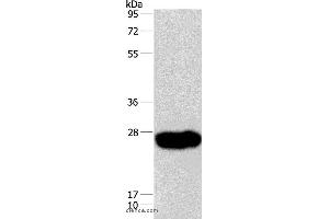 Western blot analysis of Human fetal muscle tissue, using CAV3 Polyclonal Antibody at dilution of 1:550 (Caveolin 3 antibody)