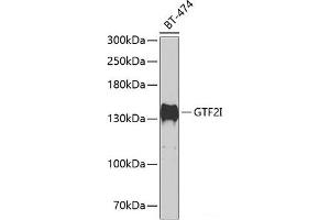 Western blot analysis of extracts of BT-474 cells using GTF2I Polyclonal Antibody at dilution of 1:500. (GTF2I antibody)
