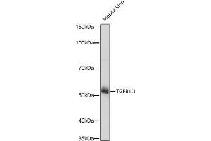 Western blot analysis of extracts of Mouse lung, using TGFB1I1 antibody (ABIN6129144, ABIN6149074, ABIN6149075 and ABIN6224526) at 1:1000 dilution. (TGFB1I1 antibody  (AA 1-150))