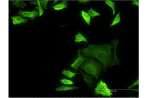 Immunofluorescence of monoclonal antibody to FLNA on HeLa cell. (Filamin A antibody  (AA 1-838))