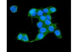 IF analysis of IQGAP2 using anti-IQGAP2 antibody (ABIN5692877). (IQGAP2 antibody  (AA 1329-1544))