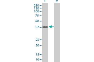 Western Blot analysis of DHRS7 expression in transfected 293T cell line by DHRS7 MaxPab polyclonal antibody. (DHRS7 antibody  (AA 1-339))