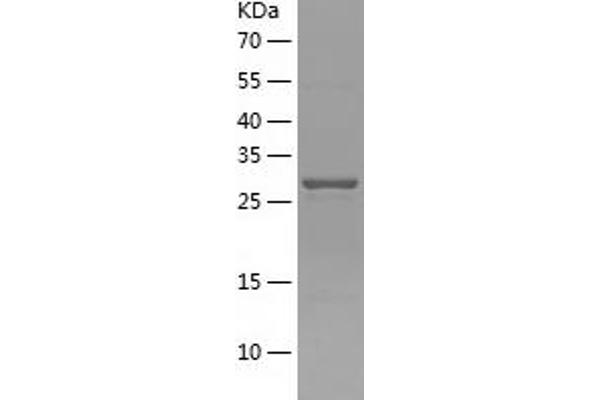 PYCRL Protein (AA 1-274) (His tag)