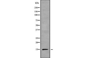 Western blot analysis of RPS15A using LOVO whole cell lysates (RPS15A antibody  (Internal Region))
