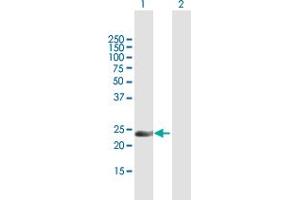 Western Blot analysis of INF2 expression in transfected 293T cell line by INF2 MaxPab polyclonal antibody.
