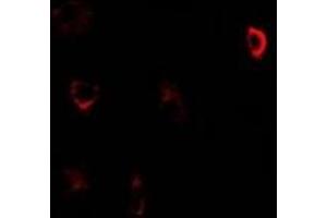 Immunofluorescent analysis of CBS staining in U2OS cells. (CBS antibody)