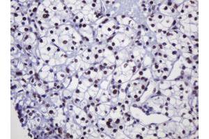 Image no. 2 for anti-Decapping Enzyme, Scavenger (DCPS) antibody (ABIN1497781) (DCPS antibody)