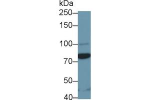 Detection of STAT3 in Rat Plasma using Polyclonal Antibody to Signal Transducer And Activator Of Transcription 3 (STAT3)