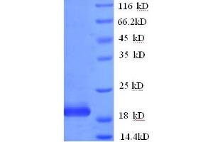 IFNA10 Protein (AA 24-189) (GST tag)