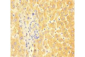 Immunohistochemistry of paraffin-embedded human liver tissue using ABIN7144419 at dilution of 1:100 (APOC3 antibody  (AA 21-99))