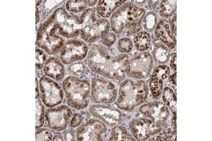 Immunohistochemical staining of human kidney with ZNF324B polyclonal antibody  shows strong cytoplasmic positivity in tubular cells at 1:50-1:200 dilution.