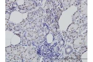 Image no. 2 for anti-Cell Division Cycle 25 Homolog C (S. Pombe) (CDC25C) (AA 21-130) antibody (ABIN598558) (CDC25C antibody  (AA 21-130))