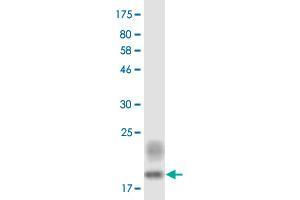 Western Blot detection against Immunogen (18. (Ectodysplasin A antibody  (AA 245-391))