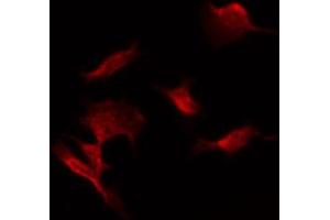 ABIN6274470 staining COLO205 by IF/ICC. (ORCTL-2/SLC22A18 antibody  (C-Term))
