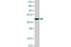 Western Blot detection against Immunogen (38. (PIKFYVE antibody  (AA 342-451))