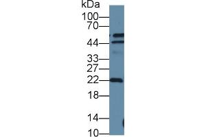 Detection of DTYMK in Human A549 cell lysate using Polyclonal Antibody to Deoxythymidylate Kinase (DTYMK) (DTYMK antibody  (AA 43-190))