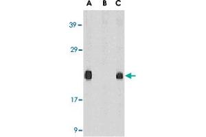 Western blot analysis of Diablo in mouse heart tissue lysate in the absence (A) or presence (B) of blocking peptide and in rat heart tissue lysate (C) with Diablo polyclonal antibody  at 1 ug /mL . (DIABLO antibody  (AA 222-237))