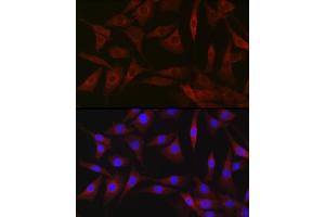 Immunofluorescence analysis of NIH-3T3 cells using BDKRB1 Rabbit pAb (ABIN7265910) at dilution of 1:250 (40x lens).