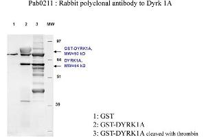 Image no. 2 for anti-Dual-Specificity tyrosine-(Y)-phosphorylation Regulated Kinase 1A (DYRK1A) antibody (ABIN347093)