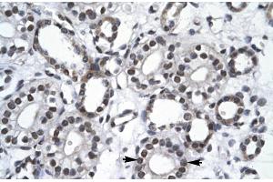 Rabbit Anti-RBM10 Antibody Catalog Number: ARP30103 Paraffin Embedded Tissue: Human Kidney Cellular Data: Epithelial cells of collecting tubule Antibody Concentration: 4. (RBM10 antibody  (N-Term))