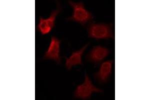 ABIN6276079 staining HuvEc by IF/ICC. (OR2T2/2T35 antibody)