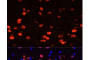 Immunofluorescence analysis of Rat brain using CALB2 Polyclonal Antibody at dilution of 1:100. (Calretinin antibody)