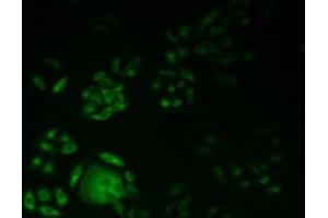 Detection of KIF18A in Human Hela Cells using Polyclonal Antibody to Kinesin Family, Member 18A (KIF18A) (KIF18A antibody  (AA 1-453))