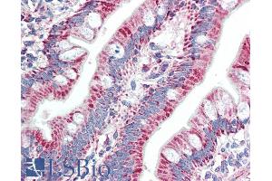 ABIN870668 (5µg/ml) staining of paraffin embedded Human Small Intestine. (ZNF652 antibody  (AA 594-606))