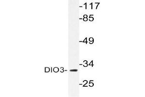 Western blot (WB) analysis of DIO3 antibody in extracts from HUVEC cells.