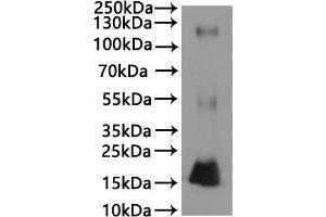 ABIN7937581, ABIN8117934 and ABIN8117935 is detected by Mouse anti-6*His monoclonal antibody.