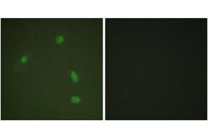 Immunofluorescence analysis of A549 cells, using Progesterone Receptor (Phospho-Ser400) Antibody. (Progesterone Receptor antibody  (pSer400))