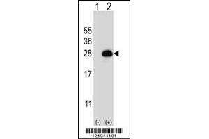 Western blot analysis of RAB3B using rabbit polyclonal RAB3B Antibody using 293 cell lysates (2 ug/lane) either nontransfected (Lane 1) or transiently transfected (Lane 2) with the RAB3B gene. (RAB3B antibody  (C-Term))
