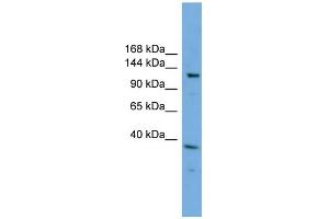 WB Suggested Anti-EIF4ENIF1  Antibody Titration: 0.