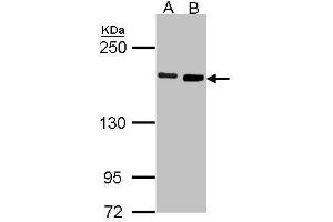 DIAPH1 antibody  (N-Term)