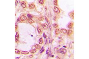Immunohistochemistry (IHC) image for anti-Pre-mRNA Processing Factor 19 (PRPF19) (Center) antibody (ABIN7298080)