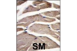 Immunohistochemistry (Paraffin-embedded Sections) (IHC (p)) image for anti-phosphofructokinase, Muscle (PFKM) (AA 746-776), (C-Term) antibody (ABIN392749)