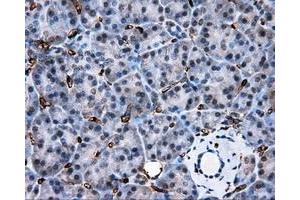 Immunohistochemical staining of paraffin-embedded liver tissue using anti-AKR1A1 mouse monoclonal antibody. (AKR1A1 antibody)