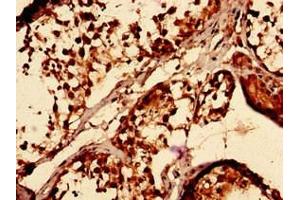 Immunocytochemistry analysis of human testis tissue using ABIN7171476 at dilution of 1:100 (TAZ antibody  (AA 95-262))