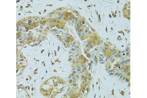MTCH1 antibody