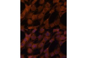 Immunofluorescence analysis of C6 cells using Legumain (Legumain (LGMN)) Polyclonal Antibody (ABIN6128201, ABIN6143172, ABIN6143173 and ABIN6214867) at dilution of 1:100 (40x lens). (LGMN antibody  (AA 18-323))