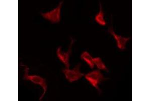 Immunofluorescence (fixed cells) (IF/ICC) image for anti-Eukaryotic Translation Initiation Factor 2 Subunit 1 (EIF2S1) (pSer51) antibody (ABIN6255389)