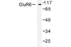 Image no. 1 for anti-Glutamate Receptor, Ionotropic, Kainate 2 (GRIK2) antibody (ABIN265439)