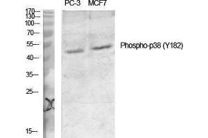 Western Blotting (WB) image for anti-Mitogen-Activated Protein Kinase 14 (MAPK14) (pTyr182) antibody (ABIN3182102) (MAPK14 antibody  (pTyr182))