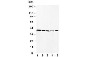 Western blot testing of CCR10 antibody and Lane 1:  HeLa (CCR10 antibody  (AA 312-327))
