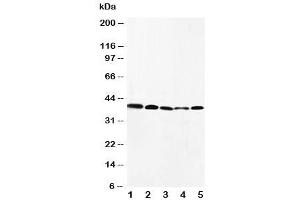 Western blot testing of CCR10 antibody and Lane 1:  HeLa